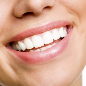 tsd_smile