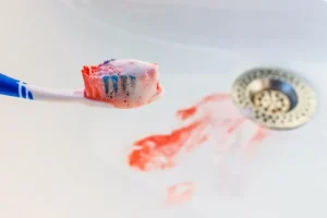 Bleeding Gums - Blood in Sink