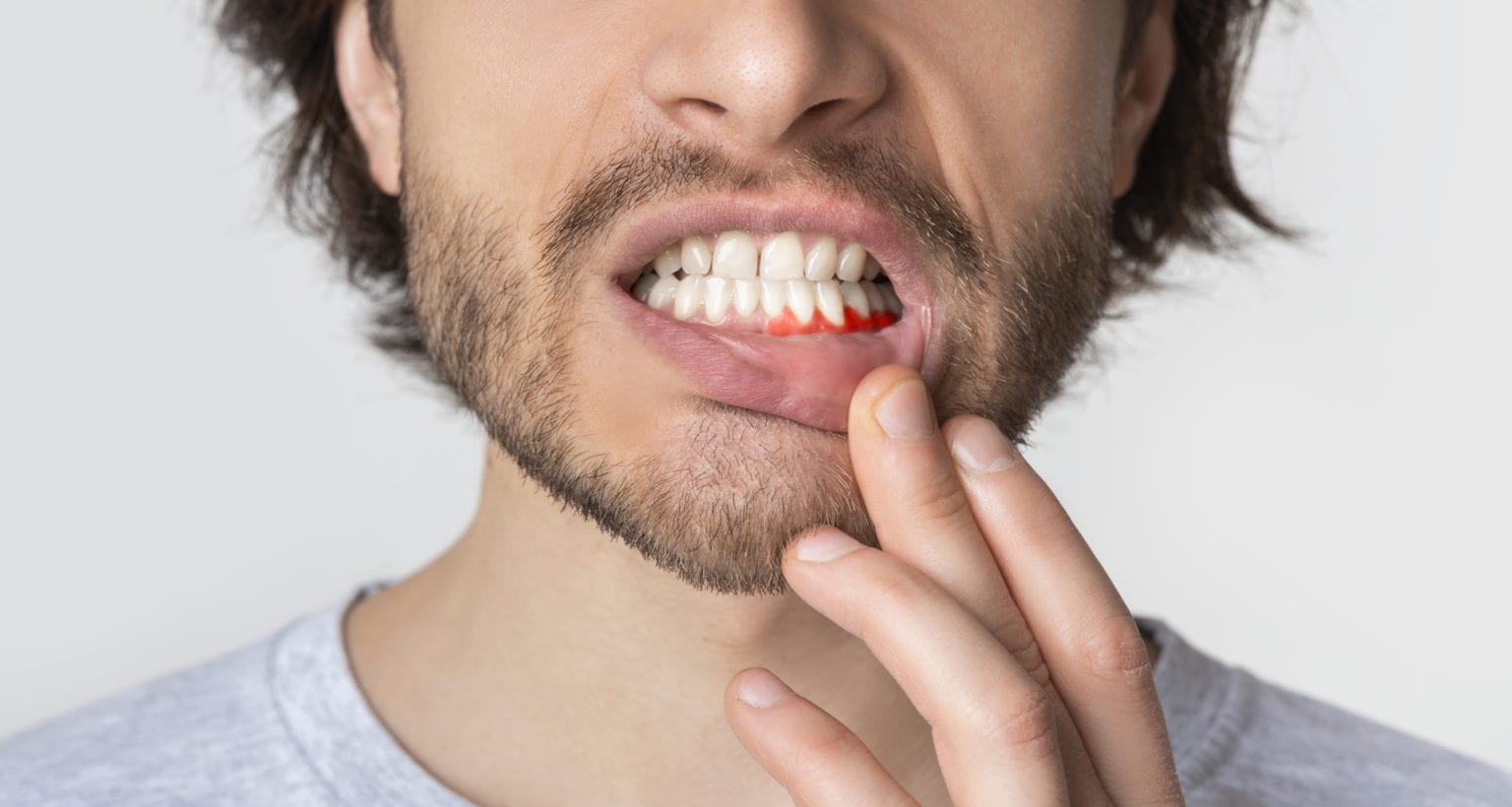 Preventing Periodontal Disease: Tips & Routine Care