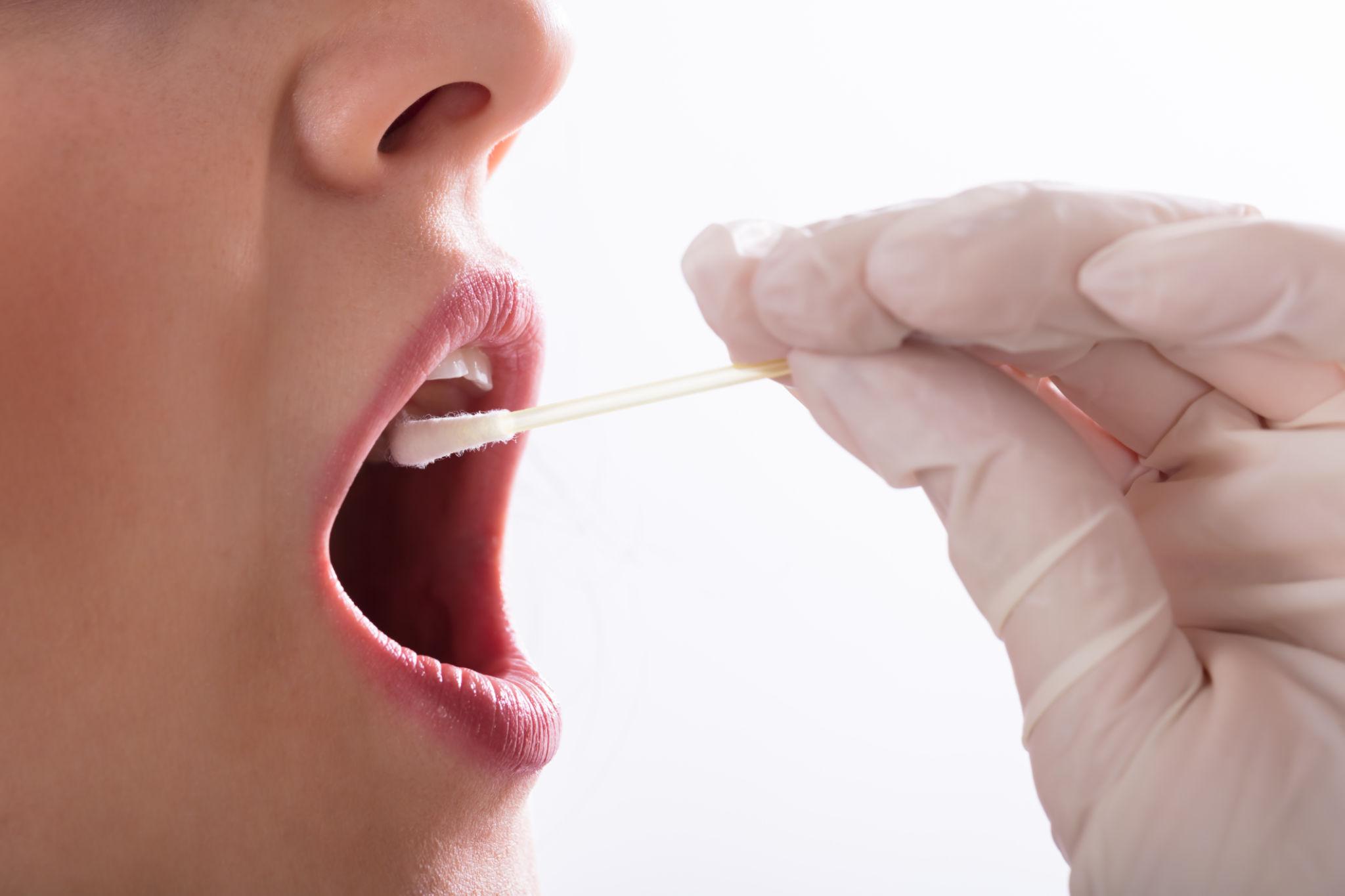 Could a saliva spit test at the dentist save you money and your health?